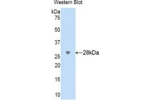 Detection of Recombinant CYP2D6, Human using Polyclonal Antibody to Cytochrome P450 2D6 (CYP2D6) (CYP2D6 anticorps  (AA 236-472))