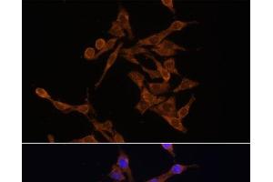 Immunofluorescence analysis of HeLa cells using UBE2J1 Polyclonal Antibody at dilution of 1:100. (UBE2J1 anticorps)