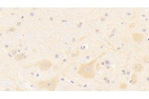 Detection of NOS1 in Mouse Cerebellum Tissue using Polyclonal Antibody to Nitric Oxide Synthase 1, Neuronal (NOS1) (NOS1 anticorps  (AA 691-826))
