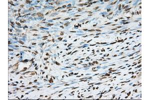 Immunohistochemical staining of paraffin-embedded Human Kidney tissue using anti-PDE4A mouse monoclonal antibody. (PDE4A anticorps)