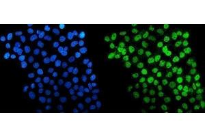 IF analysis of HDAC5 using anti-HDAC5 antibody (ABIN7599922). (HDAC5 anticorps  (AA 13-1107))