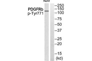 Western Blotting (WB) image for anti-Epidermal Growth Factor Receptor Pathway Substrate 15 (EPS15) (pTyr849) antibody (ABIN1847772) (EPS15 anticorps  (pTyr849))