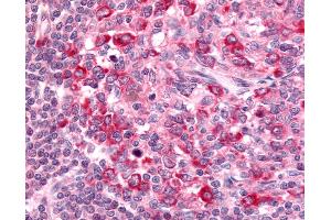 Anti-GPR65 antibody IHC of human lymph node.