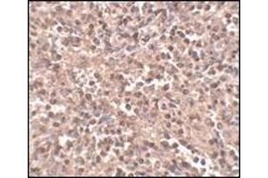 Immunohistochemistry: ATG5 antibody staining of Rat Spleen tissue lysate at 2 μg/ml (ATG5 anticorps  (N-Term))