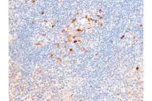 ABIN6267224 at 1/100 staining mouse spleen tissue sections by IHC-P. (CHEK1 anticorps  (pSer317))