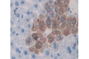 Used in DAB staining on fromalin fixed paraffin- embedded Kidney tissue (APBA3 anticorps  (AA 261-506))