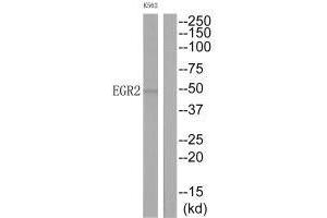 Western blot analysis of extracts from K562 cells, using EGR2 antibody. (EGR2 anticorps  (C-Term))