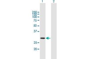 Western Blot analysis of ZBED2 expression in transfected 293T cell line by ZBED2 MaxPab polyclonal antibody. (ZBED2 anticorps  (AA 1-218))