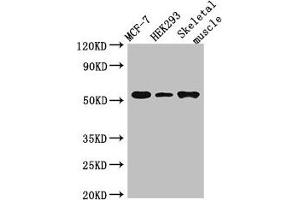 Western Blot Positive WB detected in: MCF-7 whole cell lysate, HEK293 whole cell lysate, Mouse skeletal muscle tissue All lanes: RMND1 antibody at 3 μg/mL Secondary Goat polyclonal to rabbit IgG at 1/50000 dilution Predicted band size: 52, 28, 24 kDa Observed band size: 52 kDa (RMND1 anticorps  (AA 35-160))