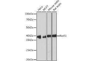 Western blot analysis of extracts of various cell lines, using Rad51 Rabbit mAb (ABIN3016792, ABIN3016793, ABIN1682438 and ABIN1682439) at 1:1000 dilution. (RAD51 anticorps)