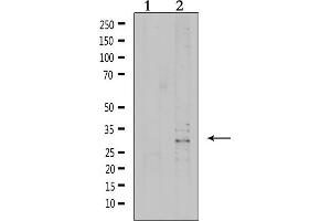 Western blot analysis of extracts from 293, using VTCN1 Antibody. (VTCN1 anticorps  (Internal Region))