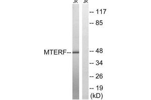 Western Blotting (WB) image for anti-Mitochondrial Transcription Termination Factor (MTERF) (Internal Region) antibody (ABIN1852304) (MTERF anticorps  (Internal Region))