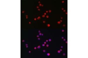 Immunofluorescence analysis of Neuro-2a cells using ALK antibody  at dilution of 1:200. (ALK anticorps  (AA 19-300))