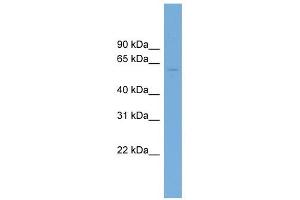 PUS10 antibody used at 1 ug/ml to detect target protein. (PUS10 anticorps  (Middle Region))