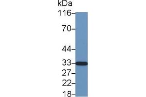 Detection of CDKN1B in Cavia Cerebrum lysate using Polyclonal Antibody to Cyclin Dependent Kinase Inhibitor 1B (CDKN1B) (CDKN1B anticorps  (AA 2-197))