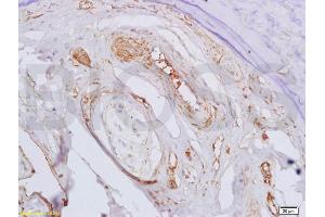 Formalin-fixed and paraffin embedded rat bone marrow labeled with Rabbit Anti BMPR1A/CD292 Polyclonal Antibody, Unconjugated (ABIN687547) at 1:200 followed by conjugation to the secondary antibody and DAB staining