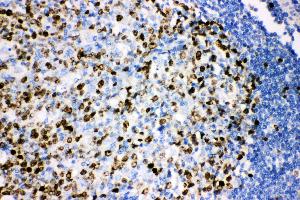 Anti-Ki67 Picoband antibody,  IHC(P): Human Tonsil Tissue (Ki-67 anticorps  (AA 2860-3256))