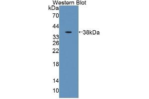 Figure. (AADAT anticorps  (AA 99-425))