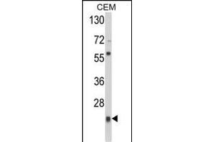 Western blot analysis of PRDX1 Antibody (Center) (ABIN389467 and ABIN2839531) in CEM cell line lysates (35 μg/lane). (Peroxiredoxin 1 anticorps  (AA 88-116))
