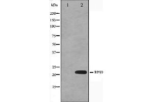 Western blot analysis on HeLa cell lysate using RPS9 Antibody,The lane on the left is treated with the antigen-specific peptide. (RPS9 anticorps  (Internal Region))