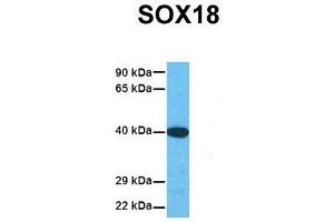 Host:  Rabbit  Target Name:  SOX18  Sample Tissue:  Human Fetal Liver  Antibody Dilution:  1.