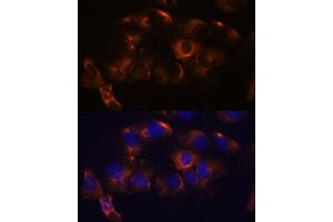 Immunofluorescence analysis of C6 cells using  antibody (ABIN7265713) at dilution of 1:100. (ATL2 anticorps  (AA 390-470))