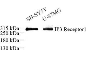 Western blot analysis of IP3R1 (ABIN7074293) at dilution of 1: 500 (IP3 Receptor anticorps)
