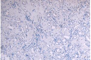 ABIN184575 Negative Control showing staining of paraffin embedded Human Kidney, with no primary antibody. (SOCS1 anticorps  (C-Term))