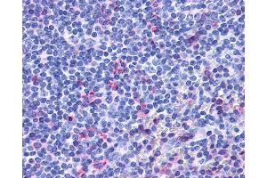 Anti-ACKR3 / CXCR7 / RDC1 antibody IHC of human tonsil. (CXCR7 anticorps  (Extracellular Domain))