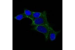 Image no. 1 for anti-Ornithine Decarboxylase 1 (ODC1) antibody (ABIN6188965) (ODC1 anticorps)
