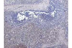 anti-Septin 1 (SEPT1) (Internal Region) antibody