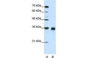 Western Blotting (WB) image for anti-Wingless-Type MMTV Integration Site Family, Member 2B (WNT2B) antibody (ABIN2462377) (WNT2B anticorps)