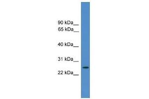 EIF4E2 antibody used at 0. (EIF4E2 anticorps  (N-Term))