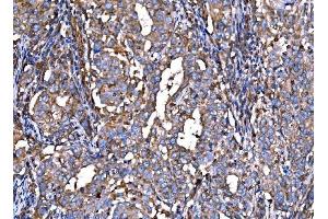 IHC analysis of RPL32 using anti-RPL32 antibody (ABIN7601826). (RPL32 anticorps  (AA 48-129))