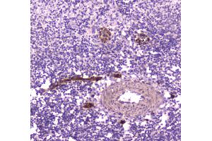 IHC analysis of CD163 using anti-CD163 antibody .