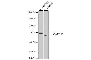 Western blot analysis of extracts of various cell lines, using Gm13125 antibody. (Pramel15 anticorps)