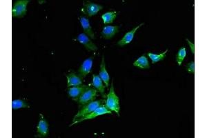 Immunofluorescent analysis of Hela cells using ABIN7175541 at dilution of 1:100 and Alexa Fluor 488-congugated AffiniPure Goat Anti-Rabbit IgG(H+L)