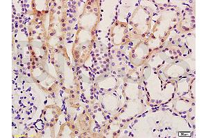 Formalin-fixed and paraffin embedded rat kidney tissue labeled with Anti-Smad7/Smad6 Polyclonal Antibody (ABIN670206), Unconjugated at 1:200, followed by conjugation to the secondary antibody and DAB staining (SMAD7 anticorps  (AA 1-100))