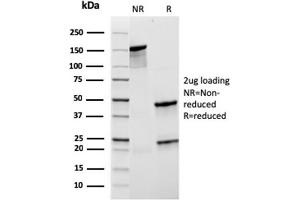 SDS-PAGE Analysis Purified CD21 Recombinant Mouse Monoclonal Antibody (rCR2/1952). (Recombinant CD21 anticorps  (AA 44-196))