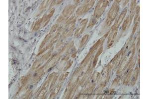 Image no. 1 for anti-Pyruvate Dehydrogenase beta (PDHB) (AA 250-360) antibody (ABIN598861) (PDHB anticorps  (AA 250-360))