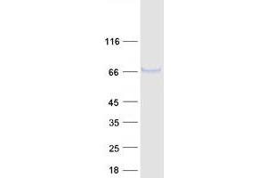 Validation with Western Blot