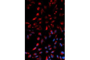 Immunofluorescence (IF) image for anti-Carboxypeptidase E (CPE) antibody (ABIN1876646) (CPE anticorps)