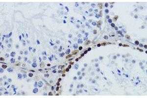 Immunohistochemistry of paraffin-embedded Mouse testis using Acetyl-Histone H2B-K12 Polyclonal Antibody at dilution of 1:200 (40x lens).