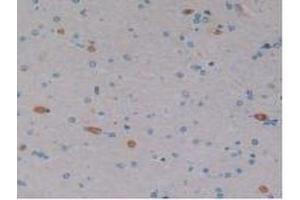 DAB staining on IHC-P; Samples: Human Brain Tissue. (EPO anticorps  (AA 28-193))