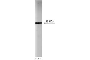 Western Blotting (WB) image for anti-Cyclin-Dependent Kinase 2 (CDK2) (AA 109-298) antibody (ABIN967777) (CDK2 anticorps  (AA 109-298))