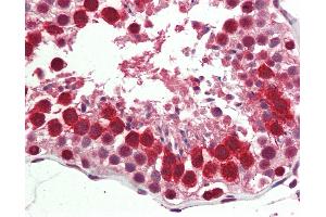 Human, Testis: Formalin-Fixed Paraffin-Embedded (FFPE) (C22orf28 anticorps  (AA 201-214))