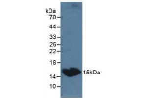 Detection of TSHb in Canine Serum using Polyclonal Antibody to Thyroid Stimulating Hormone Beta (TSHb)
