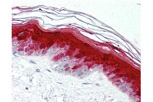 Anti-S100A7 antibody IHC of human skin. (S100A7 anticorps)