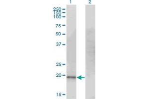 Western Blot analysis of CDO1 expression in transfected 293T cell line by CDO1 monoclonal antibody (M09), clone 4B4. (CDO1 anticorps  (AA 101-200))
