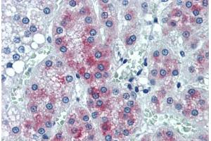 Human Adrenal: Formalin-Fixed, Paraffin-Embedded (FFPE)